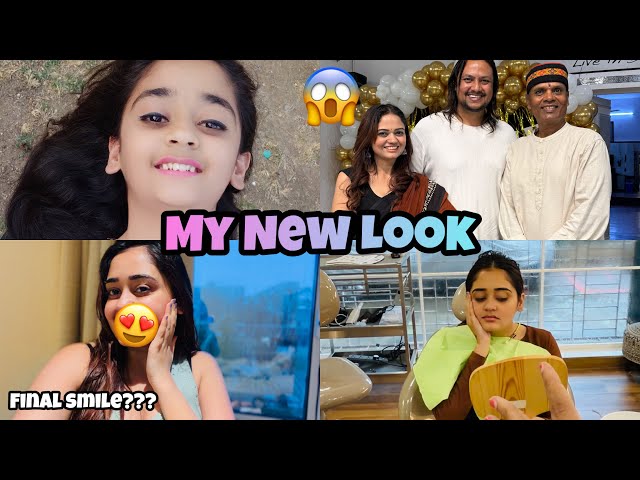 Meeting some one special in Mumbai 😍 Kavya ka New Look 😱 Surgery Gone Wrong 😑 Bindass Kavya