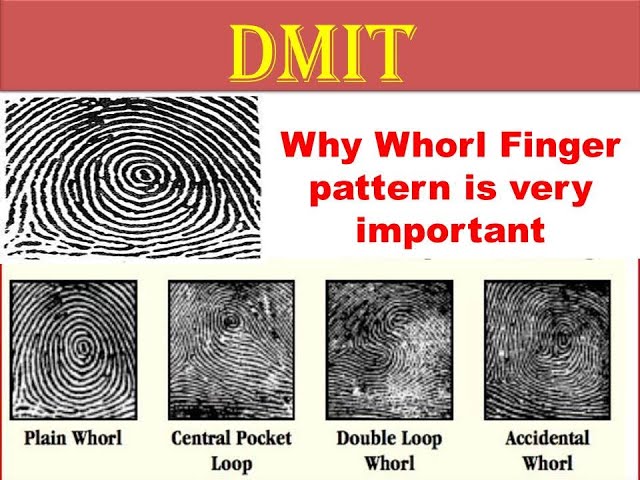 Dmit Training whorl pattern  Analysis