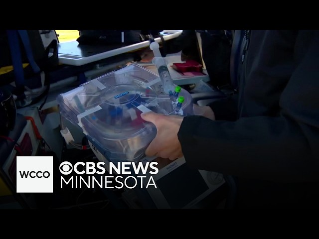 ECMO program expands to rural Minnesota, saves woman's life
