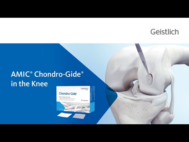 AMIC® Chondro-Gide® in the Knee