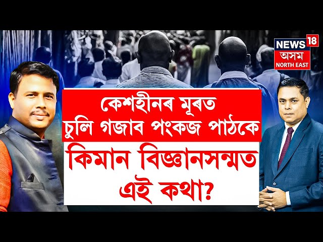 LIVE | PRIME DEBATE |  কেশহীনৰ মূৰত চুলি গজাবপংকজ পাঠকে | কিমান বিজ্ঞানসন্মত এই কথা? Pankaj Pathak