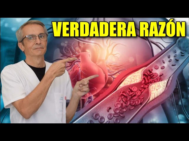 Why your ARTERIES become CALCIFIED and RIGID The REAL reason