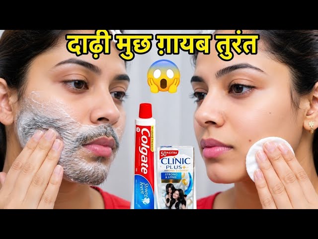 Doctor Reveals Easy Way to Remove Facial Hair with Shampoo Painlessly || FacialHair Removal