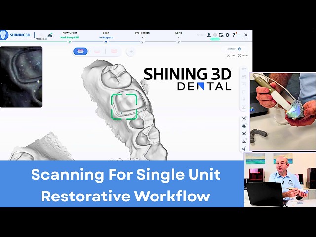 Scanning For Single Unit Restorative Workflow By Shining 3D