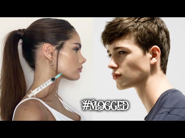 ( 1𝒳 ) SHARP FACE 𓏴 FORWARD GROWTH MAXXING ౨ৎ 💉  complete facial structure enhancement