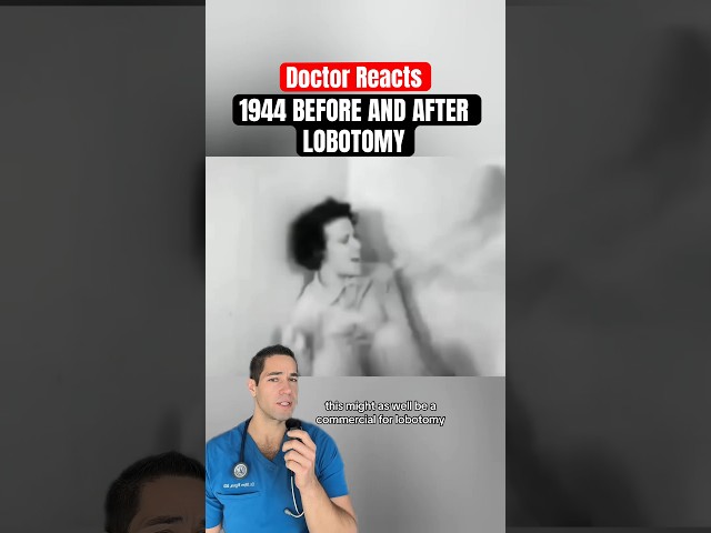 Doctor Reacts: lobotomy before and after