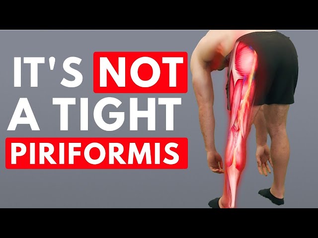 Sciatica Isn’t What You Think – Here’s the REAL Fix