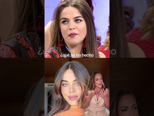 What did she get done to her face? ⤴️