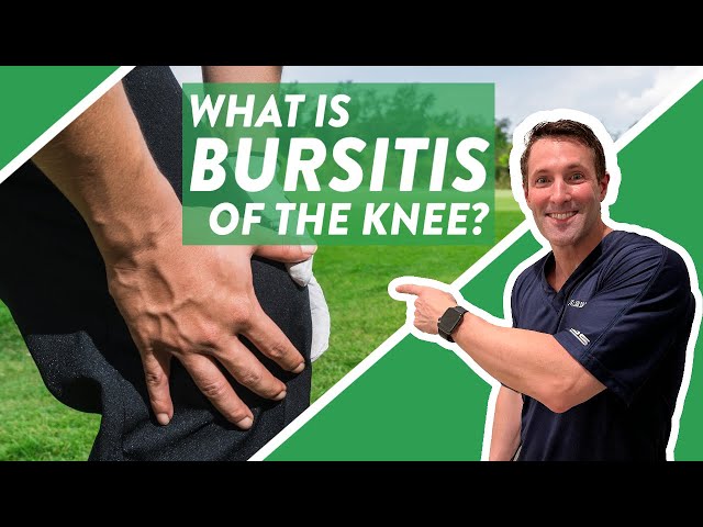 What is bursitis of the knee?