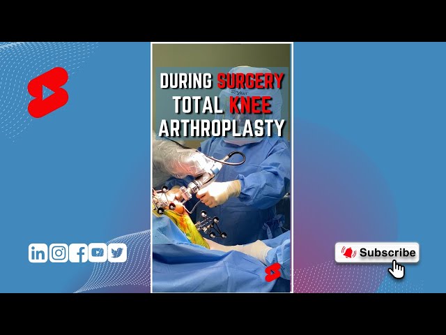 Total Knee Arthroplasty 🪚 #shorts #bonecuts #orthopedics