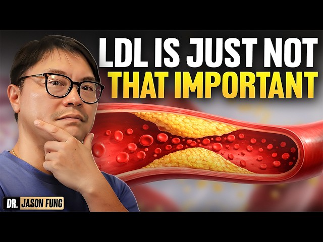 Cholesterol is barely relevant to heart disease.