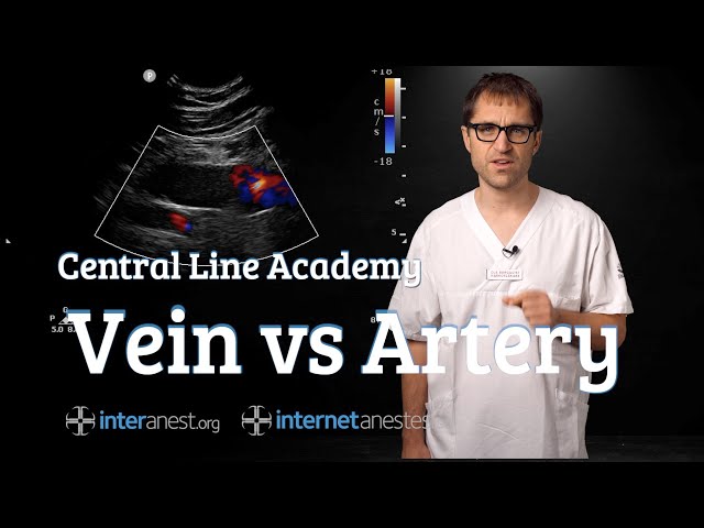 Central Line Academy: Vein vs Artery
