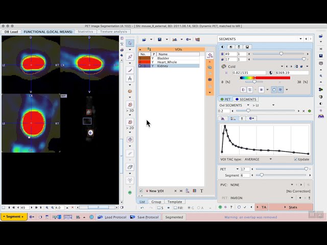 S6E1 Automated organ segmentation with dynamic PET/MR