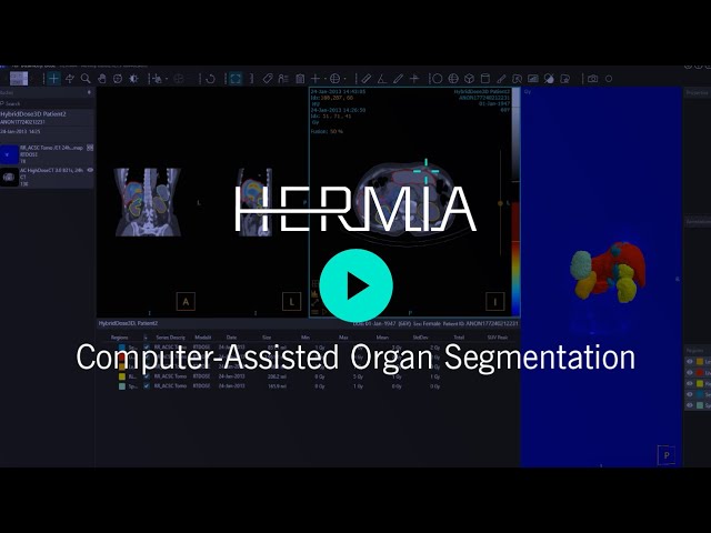 Computer-Assisted Organ Segmentation in Hermia
