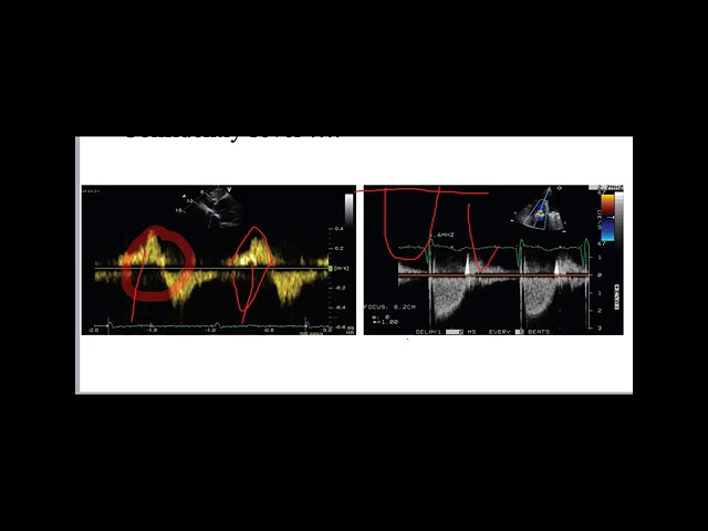 Bits and peices of cardiac datap Part 2