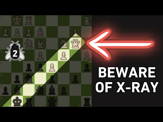 10 Year Old Stunned Me With An X-Ray Tactic