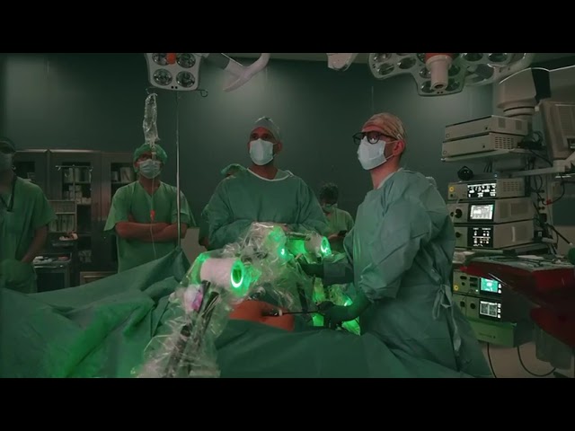 First Live Surgery with AVROS P! | A Major Milestone in Laparoscopic Surgery