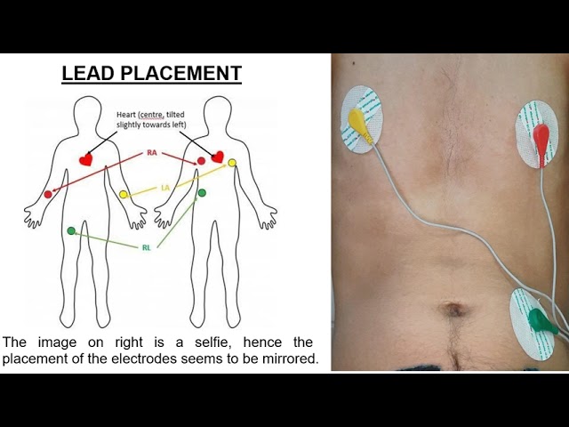 IoT-Based Remote Patient Monitoring System to Measure Vital Body Signs