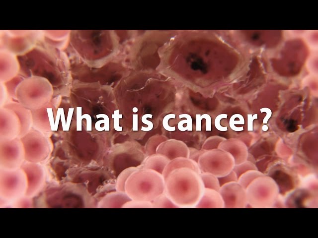 What is cancer? What causes cancer and how is it treated? *UPDATE*
