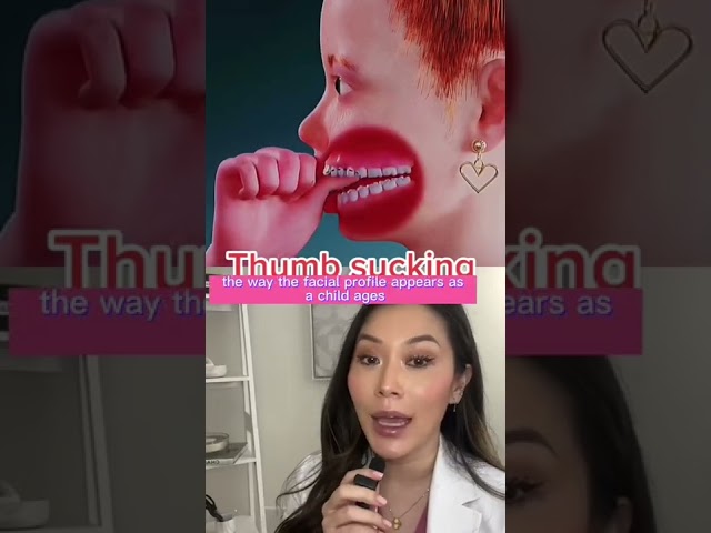 What does thumb sucking do long term? #thumbsucking #suckingypurthumb #dentist #cosmeticdentist