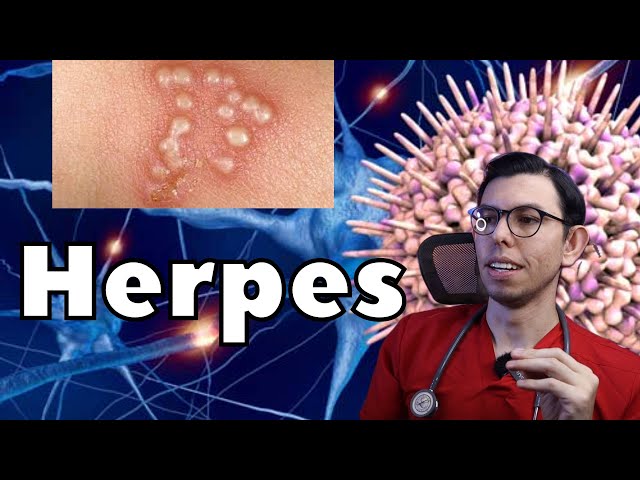 ¡TODO lo que debes conocer sobre HERPES! | Drpologuerrero