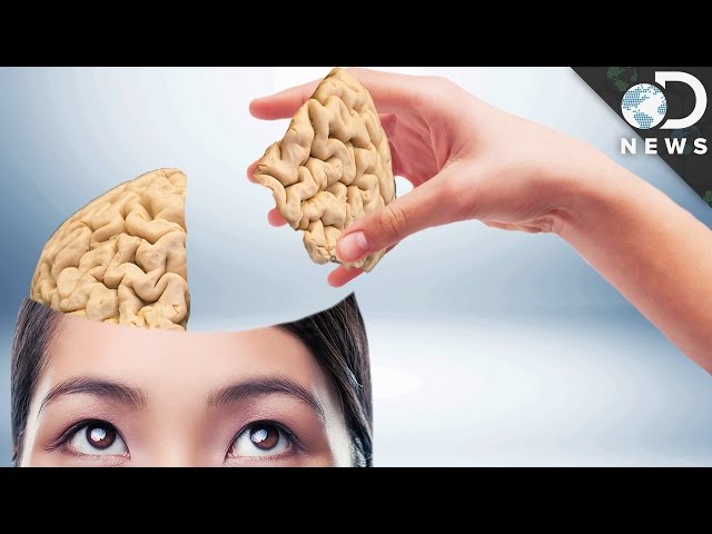 Can You Live With Only Half Of Your Brain?