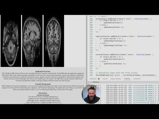 Debugging 3D Brain MRI Viewer: Solving Volumetric Data Rendering Issues in JavaScript and Flask