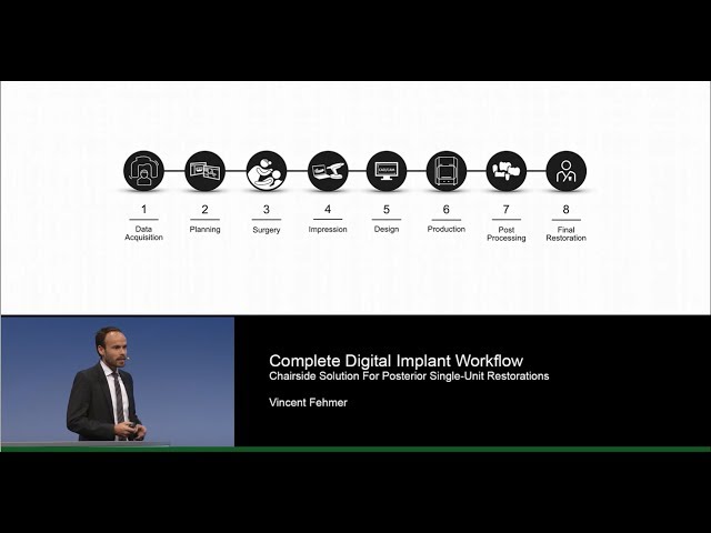 Vincent Fehmer: Complete Digital Implant Workflow