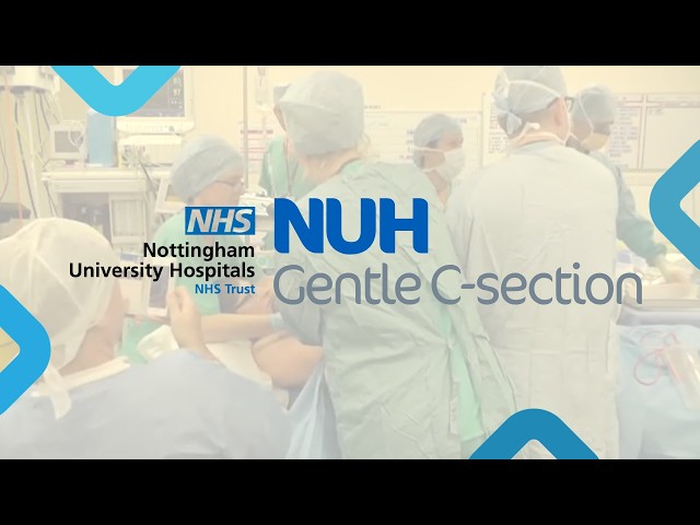 NUH Maternity - Gentle c section