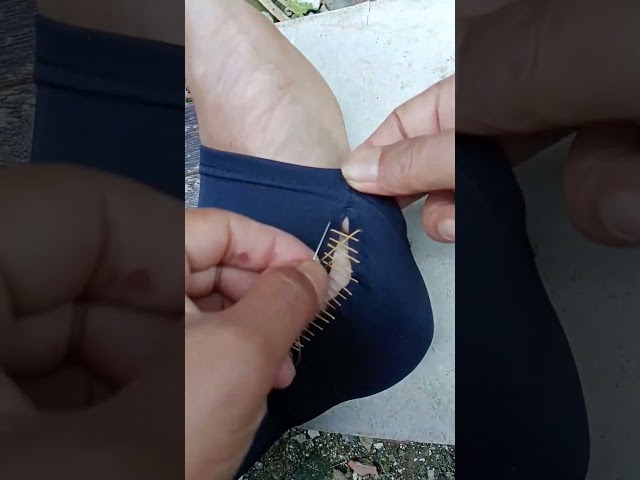 Step-by-Step Invisible Sock & Leggings Mending Tutorial