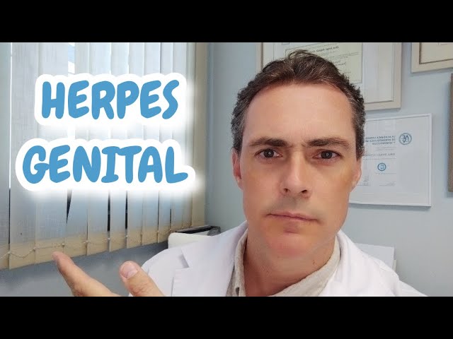 Dermatologist shares the most relevant information about genital herpes