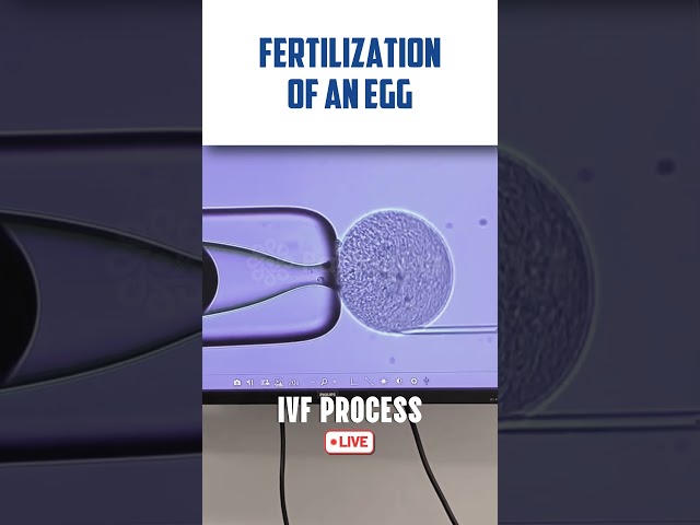 IVF transfer procedure LIVE VIDEO 🔴 Fertilization of Egg & Sperm in Human #fertilization #ivfprocess