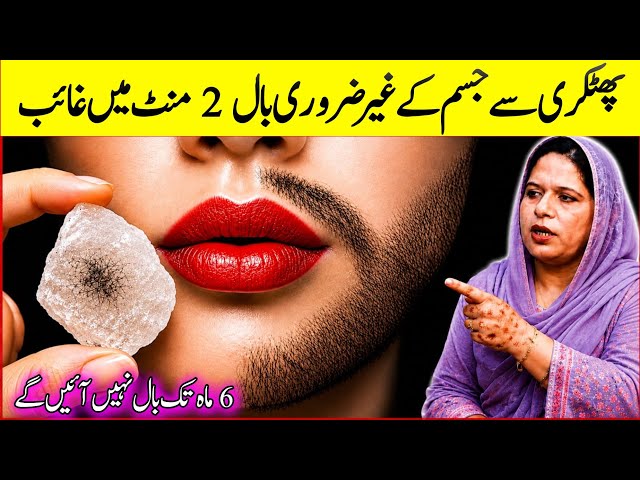 Without threading👉🏻😱I'm surprise how aunty's beard &moustache removed|facial hair removal at home