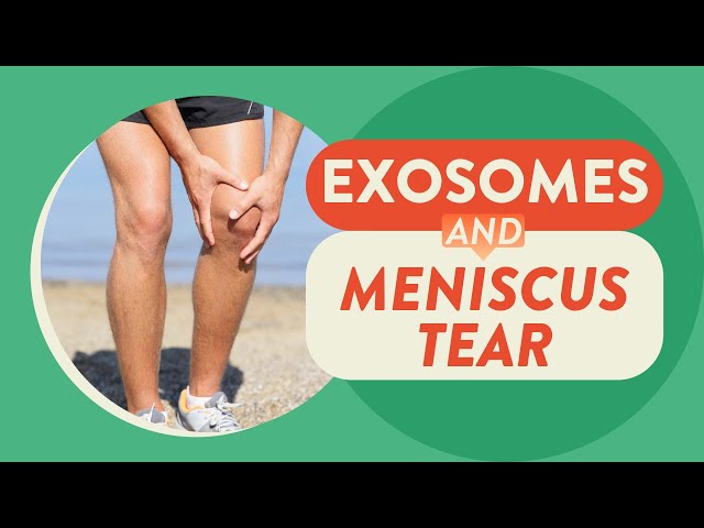 Exosomes and meniscus tear