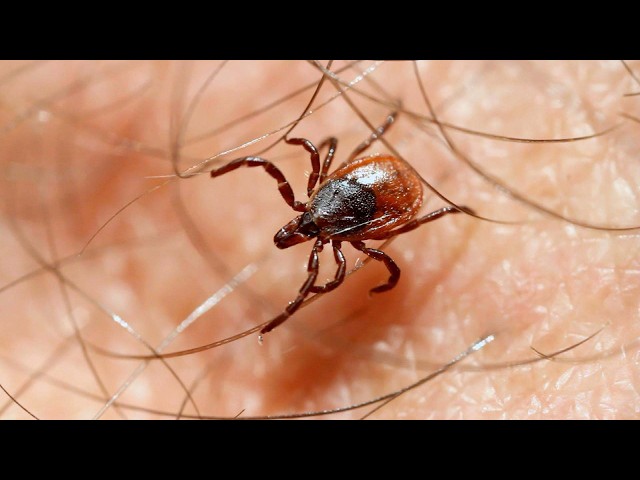 Tick Season Is Ick Season
