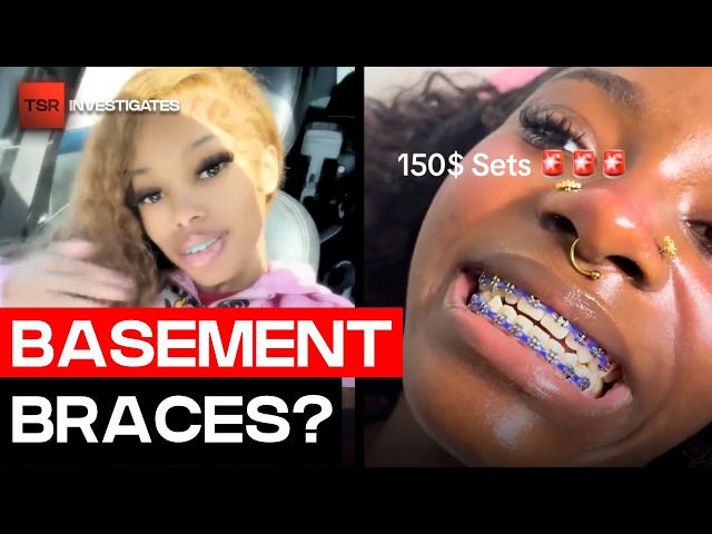 “Basement Braces” Are Going Viral And Dentists Are Concerned | TSR Investigates
