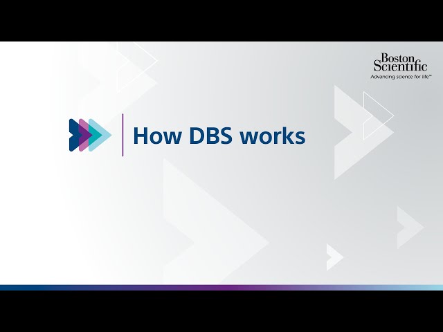How Deep Brain Stimulation (DBS) Therapy Works