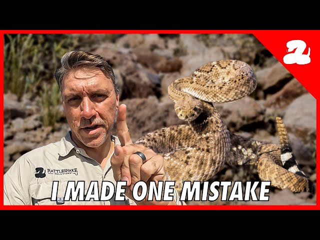 I Was Bitten by a Rattlesnake | My Story