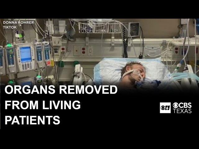 Federal review finds organ group acted on donors who were still alive