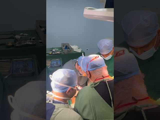 Hepatectomy I Advanced GI SURGERY I Liver Team I Surat I India