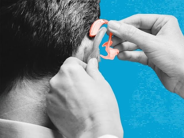 Exposed: 5 Best Hearing Aids for Sever or Profound Hearing Loss