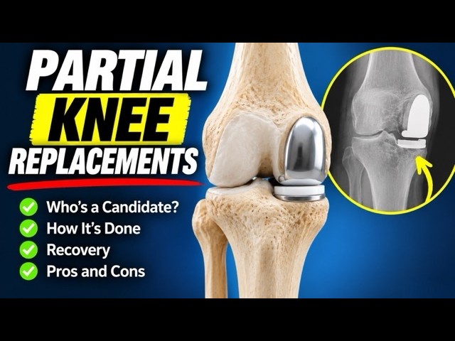 Is Partial Knee Surgery Right For You?