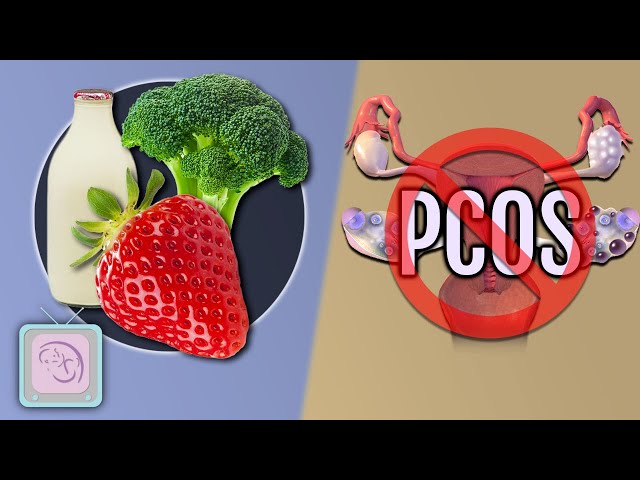 PCOS Diet Plans - Which natural diet is best for weight loss? Fertility?