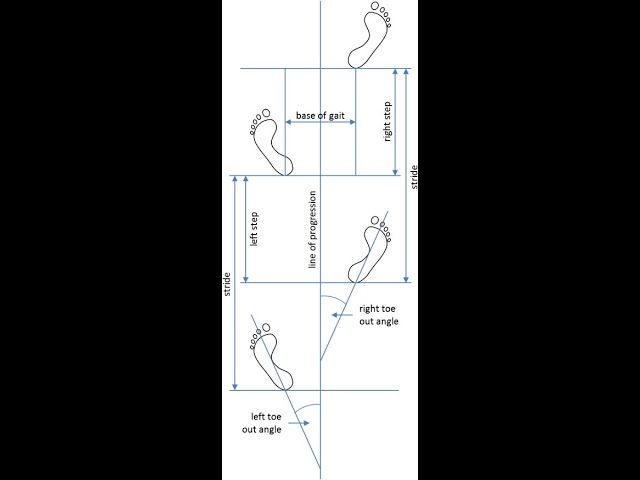 " GAIT PATTERN ANALYSIS IN PERSPECTIVE OF FORENSIC SCIENCE INVESTIGATION "