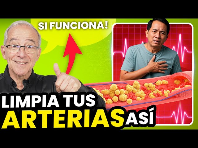 🧽 LIMPIA TUS ARTERIAS ASI Antes De Que Sea TARDE - Oswaldo Restrepo RSC