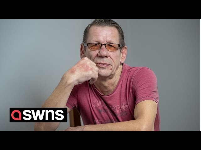 Brit travels to Ukraine for dental treatment - after he couldn't get an appointment in the UK | SWNS