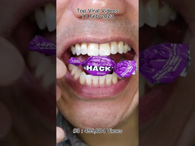 Most Satisfying Candy & Chocolate ASMR 🍫🍬 #DoctorTristanPeh #ASMR