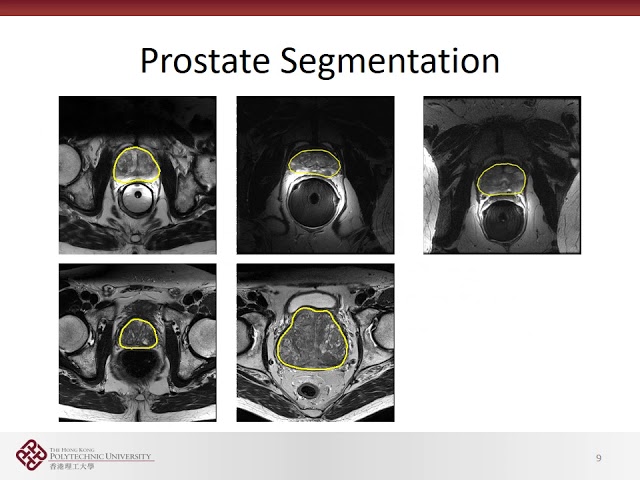 SN5119 Medical Image Processing     Deep Learning for Medical Image Processing