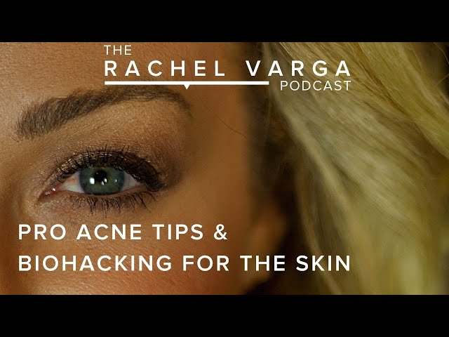 Acne Tips & Biohacking For The Skin with Rachel Varga