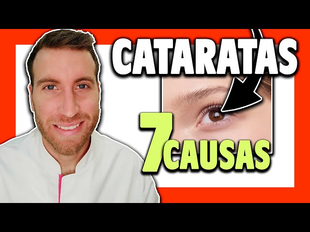 🟥 ¿Qué son las CATARATAS en los OJOS y por qué se producen? #1